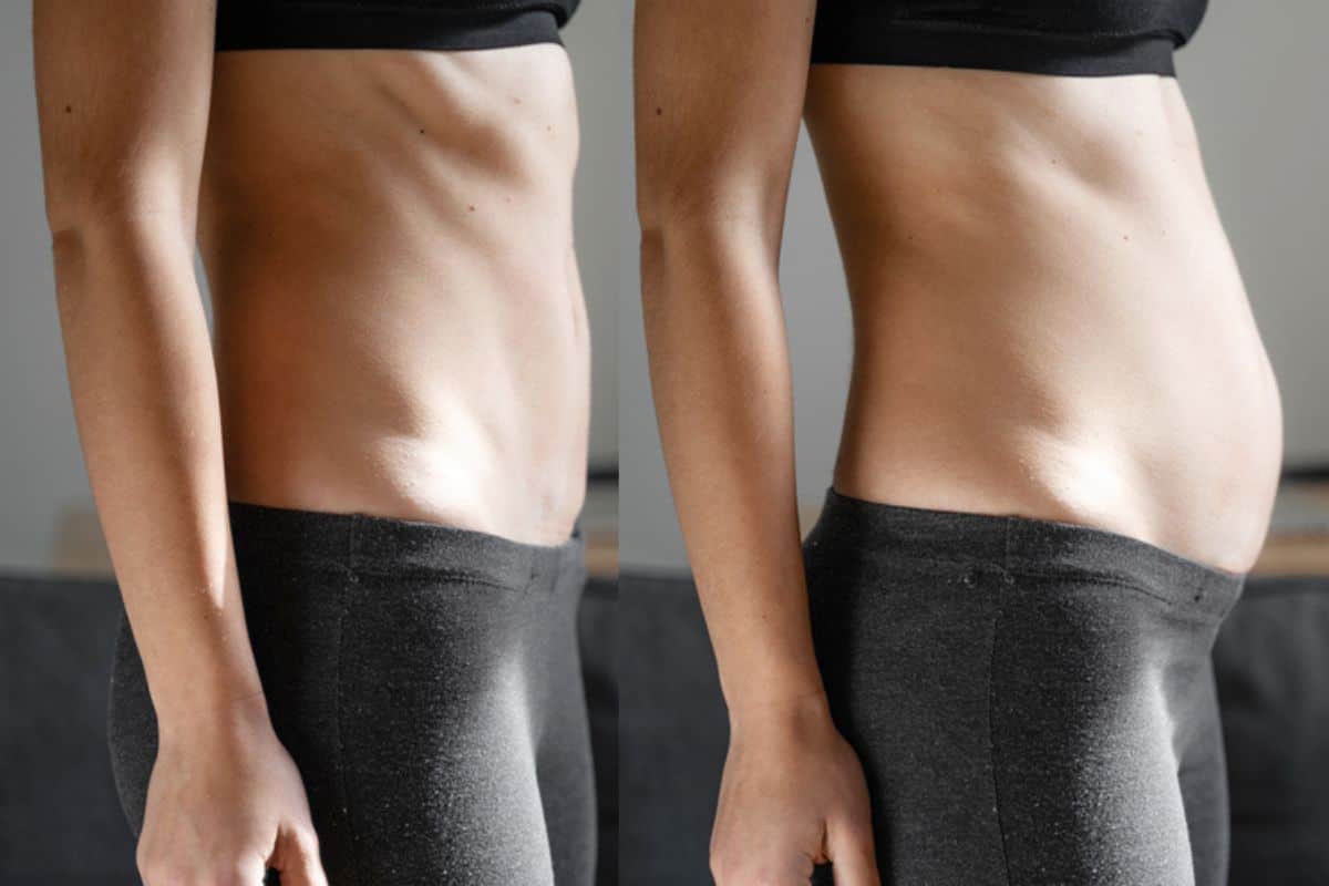 How long does diastasis recti take to improve Shoreham-by-Sea?