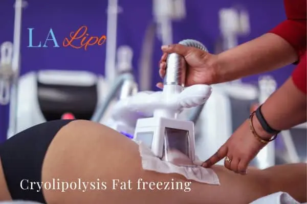 women getting fat freezing Shoreham-by-Sea