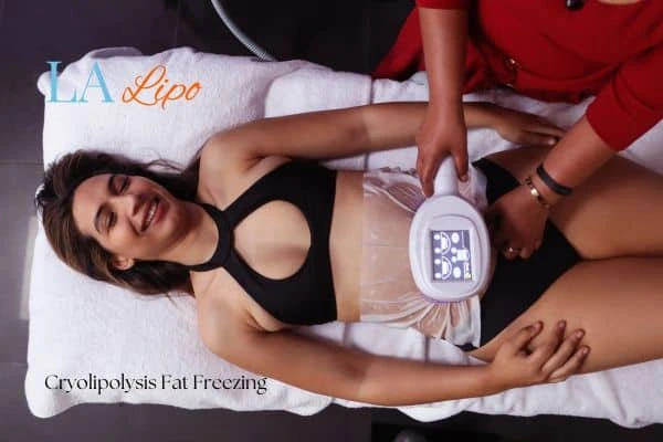 woman getting cryolipolysis Shoreham-by-Sea