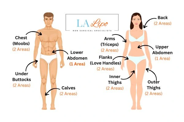 LA LIPO Cryolipolysis Areas Shoreham-by-Sea