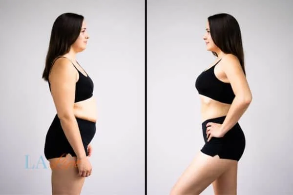 link between body image and mental health Shoreham-by-Sea