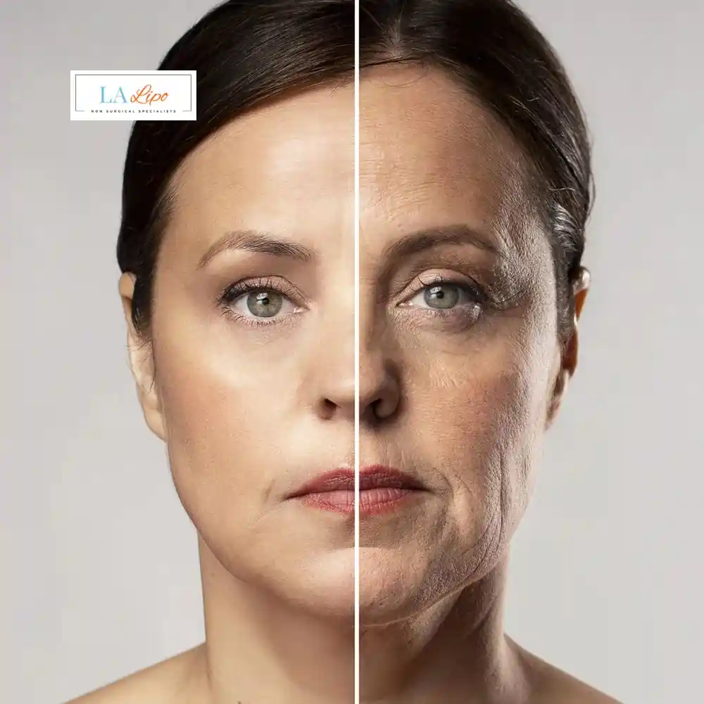 How Can You Tell If Non-Surgical Skin Tightening Is Right for You Shoreham-by-Sea?