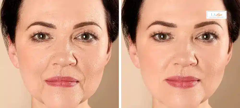 How Long Does It Take to See Results and How Long Do They Last Shoreham-by-Sea?