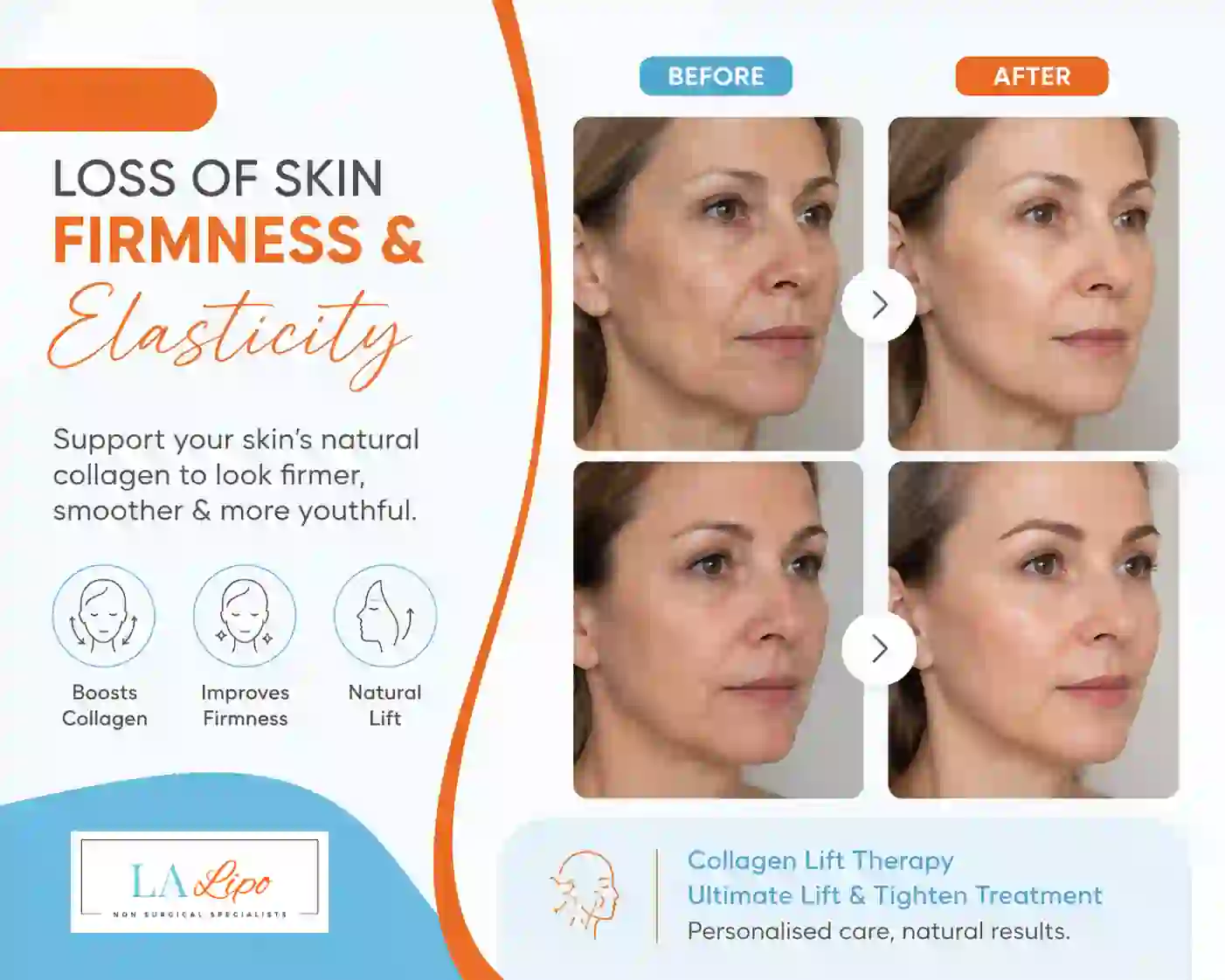 Sign #7: Loss of Skin Firmness and Elasticity Shoreham-by-Sea